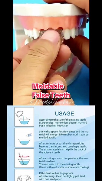 Get that Beautiful Smile Back with Thermal-Forming False Teeth