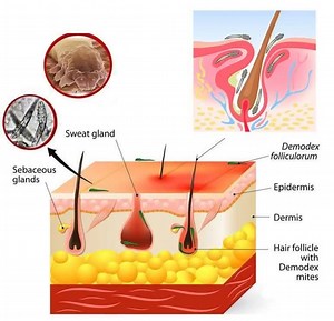 4.6K views · 33 shares | What Are Demodex Mites? Demodex mites are...