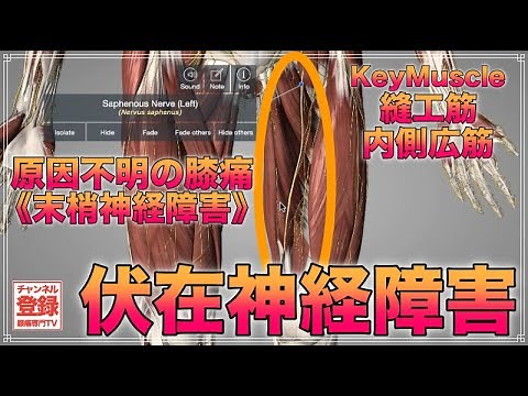 【原因不明のひざ痛】伏在神経障害《縫工筋,内側広筋》entrapment neuropathy of the infrapatellar branch of the saphenous nerve.