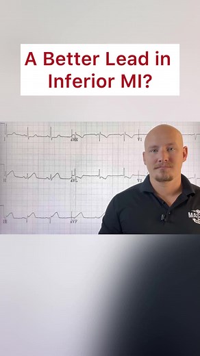 Understanding Myocardial Infarction in Paramedic Training