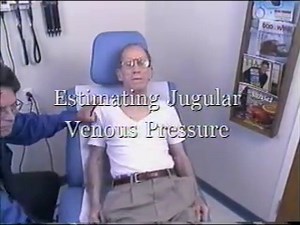 What it Looks Like: Jugular Vein Distention