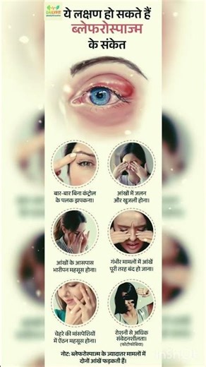 👉 “आंखों का बार-बार फड़कना हो सकता है खतरनाक!”👉 “ये लक्षण हैं Blepharospasm के संकेत”