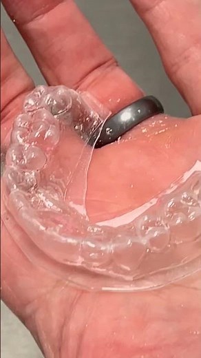 How we make Your Orthodontic Retainers? Step by step process.