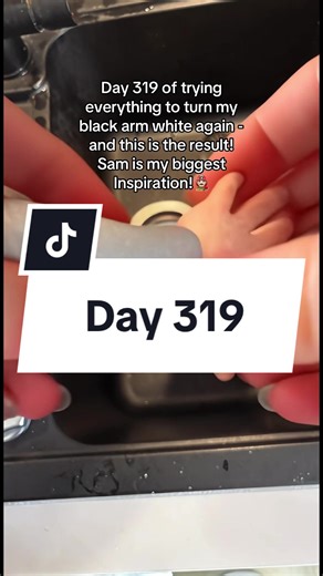 Day 319 of cleaning my black arm! #day1 #day501 #cleaning | black removal