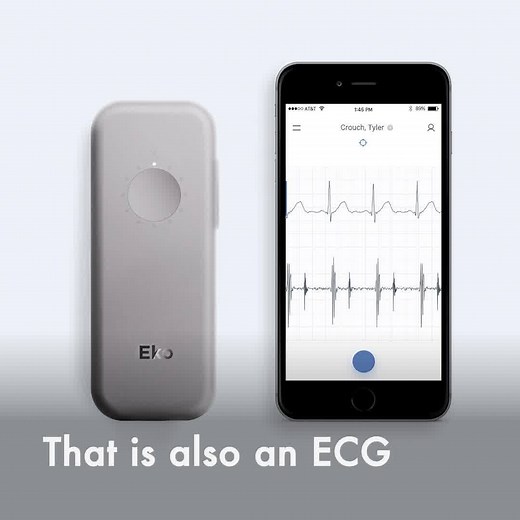 1.9K views · 249 reactions | Screen wirelessly, visualize ECG tracings, amplify heart, lung & bowel sounds, analyze with FDA-cleared AI. You've never seen a stethoscope like this. | Eko Health | Facebook