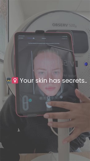 🔬 What does the OBSERV 520x do? It scans beneath the surface to reveal hidden skin concerns like pigmentation, dehydration, oiliness, and sun damage — helping tailor your perfect skincare plan. To book in, please contact the clinic today!⠀⠀⠀ 📧 info@eyeslidsandface.ie⠀⠀⠀⠀⠀ 🌐- www.eyeslidsfaceclinic.ie 📞 353 (0) 65 672 4160⠀⠀⠀⠀ .⠀⠀⠀ .⠀⠀⠀ .⠀⠀⠀ #EyesLidsFace #Sofwave #SkinTightening #NonSurgicalFacelift #FacialRejuvenation #SkinGoals #CollagenBoost #ClinicDiaries⠀