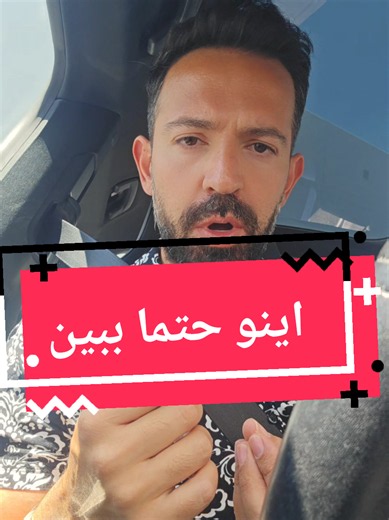 من ادوین هستم، وکیل حوادث و صدمات شخصی در آمریکا 📞 702-337-3430 🏆 انتخاب شده به عنوان یکی از ۴۰ وکیل برتر در ایالات متحده اگر تصادف کرده‌اید یا آسیب دیده‌اید، همین حالا با من تماس بگیرید — مشاوره رایگان I’m Edvin Jones, Your personal injury attorney 📞 702-337-3430 🏆 Recognized as one of the Top 40 Attorneys in the U.S. If you’ve been in an accident or injured, call now for a 100% free consultation. 818 E Charleston Blvd Las Vegas, Nevada 89104 www.edvin.law #وکیل_لاس_وگاس #FarsiLawyer #LasVe