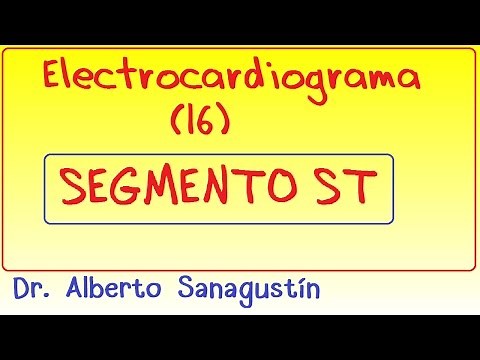 Electrocardiograma (16): Segmento ST