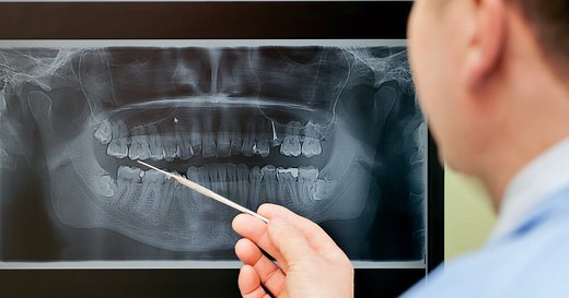 How to Get a Panoramic Dental X-Ray, Costs & Procedure