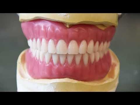 Part of the Process - Setting Denture Teeth for a Wax Try-In