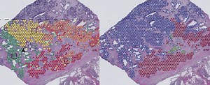 Genetic mapping of tumours reveals how cancers grow | University of