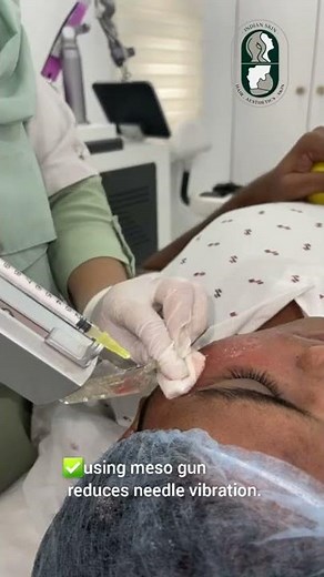 PRP therapy using a meso gun