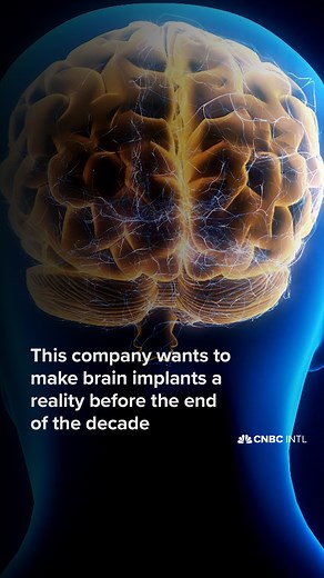 Your brain is made up of around 85 billion neurons, so creating a device to get data in and out of the brain is no easy task. But start-up Paradromics wants to do just that - and wants to bring it to market by as soon as 2029. | CNBC International