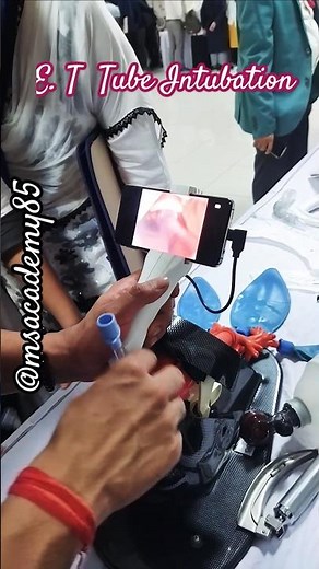 Endotracheal Tube Intubation procedure l Visual Laryngoscope l Demonstration video. #neet #mbbs