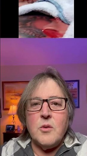 Pus Fountain from An Infected Tattoo