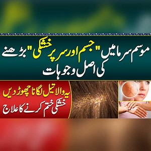 Moisturizer For Dry Skin - Sardion Me Dandruff Qn Hota Ha - Causes & Best Treatment For Dry Skin & Dandruff in Winters | Sehat Mand - Health & Lifestyle