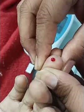 How to check PT-INR BLOOD TEST Using BY STRIP EASY WAY EXPLAIN #bloodtest