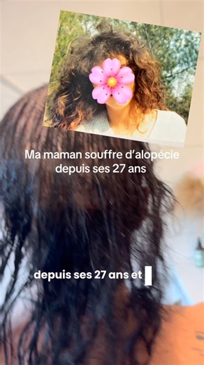 Clara - Coach capillaire au naturel on Instagram: "Alopécie androgenique et minoxidil : quels sont les risques ? Commente « produit » pour recevoir la liste de produit utilisé Ma maman souffre d’alopécie depuis ses 27 ans et à l’époque on lui avait proposé comme solution de prendre du Minoxidil mais... c’est pas toujours la solution. Pire, sur certaines personnes, ça peut aggraver la chute, surtout sans suivi médical et surtout c’est pas top d’un point de vue santé... L’essentiel, c’est de repar