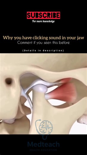 Why Does Your Jaw Click? 😬 | Hidden TMJ Problem Explained #youtubeshorts #facetasm