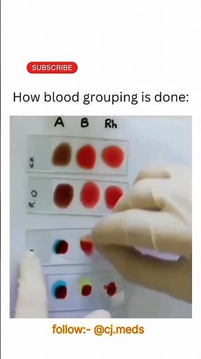Blood group test | How to know your blood group | 🩸🩸🩸
