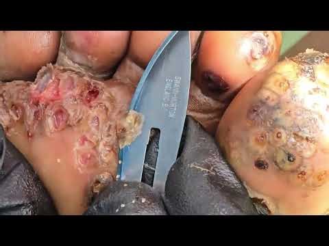 From Suffering to Salvation: Manasses’ Deliverance & A Call to Join the Mission