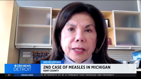 Measles, mumps cases detected in Metro Detroit