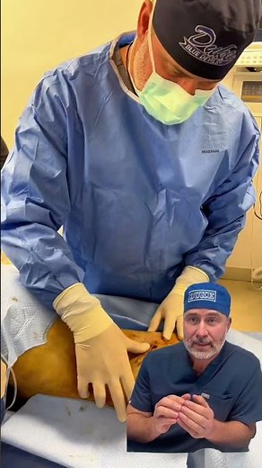 How Rib Remodeling Works: Surgical Walkthrough with Dr. Earle