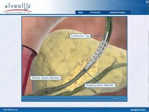 Biliary Stent Animation - Interactive medical media