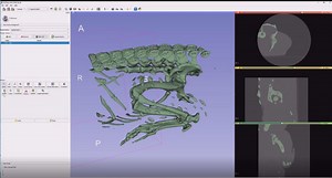 CT data to 3D print in 15 minutes using free software