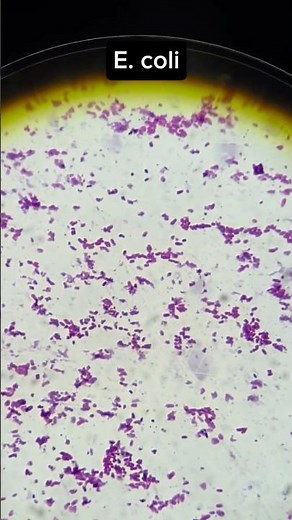Gram-Stained E. coli Under Microscope – Real Lab View #microbiology #microscope