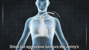 2.4K views · 161 reactions | From X-rays to PET and CT scans to theranostics, learn how medical imaging for cancer care has evolved over the decades. | International Atomic Energy Agency (IAEA) | Facebook