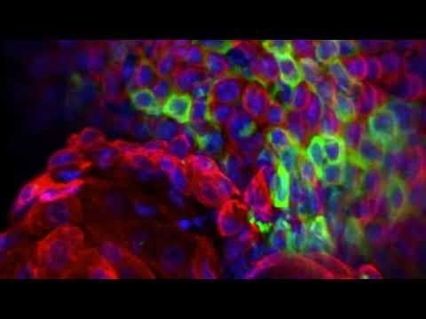 JID October 2025 Cover: Epithelial Fibronectin Meshwork Controls Skin Regeneration