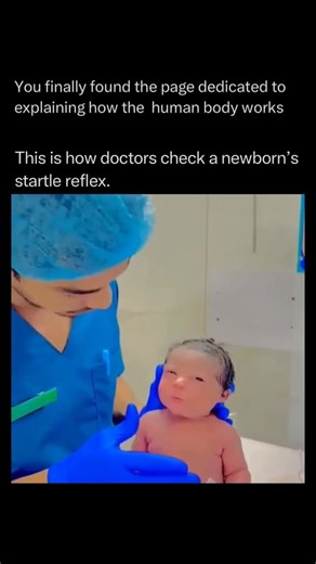 The Human Body 🧬 on Instagram: "Follow @explainingthebody to learn everything about the human body one post at a time 🧠⚙️ The startle reflex, scientifically known as the Moro reflex, is a primitive involuntary response that acts as a vital indicator of a newborn’s developing nervous system. When a baby feels a sudden loss of support or hears a loud noise, their brain triggers a symmetrical “fight or flight” reaction: they suddenly spread their arms wide, pull them back in, and usually cry. Thi