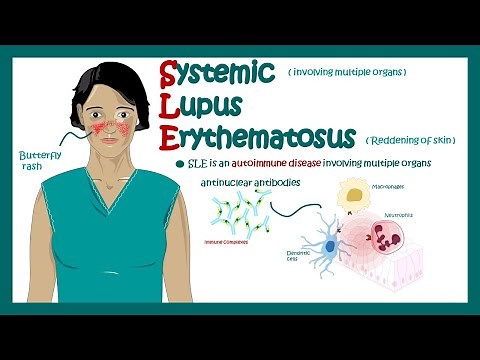 Systemic Lupus Erythematosus | signs and symptoms, pathophysiology, and diagnosis of Systemic Lupus