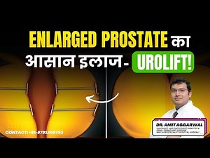Enlarged Prostate का आसान इलाज – UroLift Explained in Hindi! | Dr. Amit Aggarwal