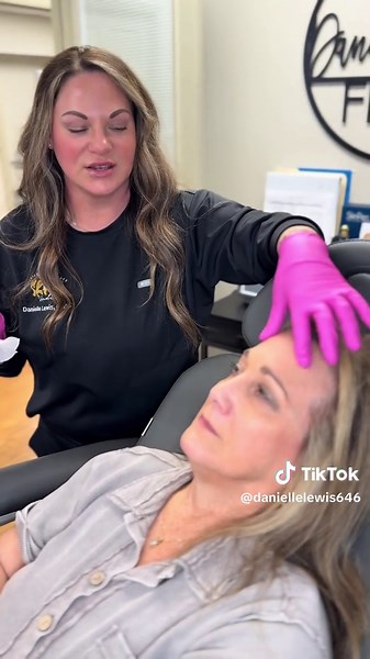✨ The artistry behind Danielle’s signature “Tox Lift” ✨ When it comes to achieving that perfectly refreshed, lifted look — it’s all about placement and precision. By treating higher on the frontalis muscle, we create a smooth, natural finish across the forehead while intentionally leaving the lower portion active to allow gentle movement. This technique enhances the brow lift effect — because true lift actually comes from relaxing the depressor muscles of the face, not over-freezing the areas th