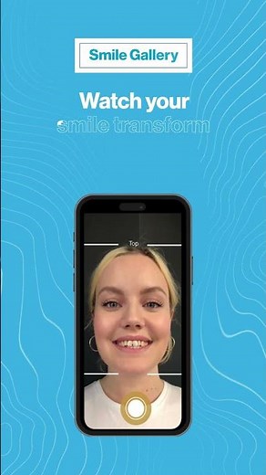 Starting Invisalign Treatment? Say 👋 to the My Invisalign™ App