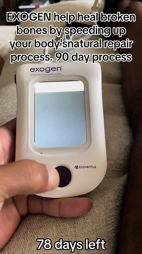 How EXOGEN Helps Heal Broken Bones Effectively