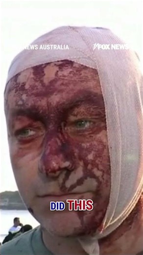 WATCH: Survivor of Oct 7 narrowly escapes Australia terror attack #foxnews #news #shorts #world