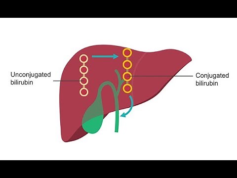 Analyzing liver function–How to use lab values