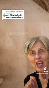 Tips for Back Acne: How to Get Rid of Back Acne