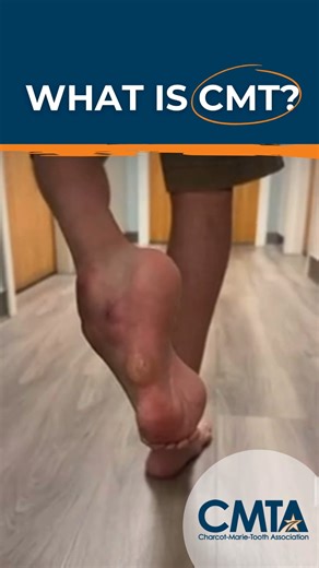 7.6K views · 73 reactions | What is Charcot-Marie-Tooth disease...