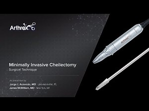 Minimally Invasive Cheilectomy