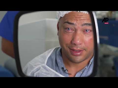 Keratopigmentation -the eye color-changing surgery explained