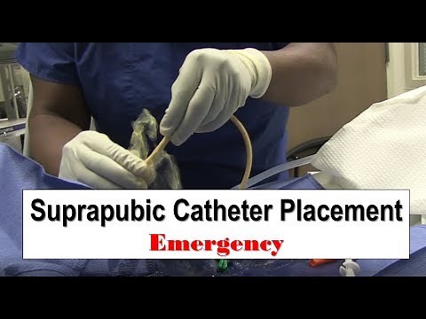 Suprapubic Catheter Placement • Video • MEDtube.net