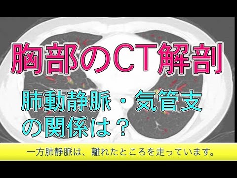 胸部CTの解剖の基礎(Chest CT) #概要欄に無料講座あり。