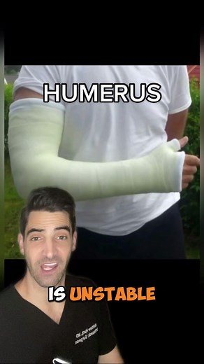 Understanding Humerus Fractures: Surgery Required for Unstable Breaks