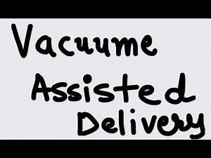 Vacuum Assisted Delivery -