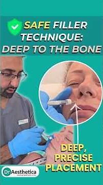 Periosteal Piriform Fossa Filler & Chin Enhancement | Safe, Deep Injection Technique