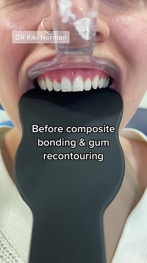 haymarketDentalEdinburgh on TikTok